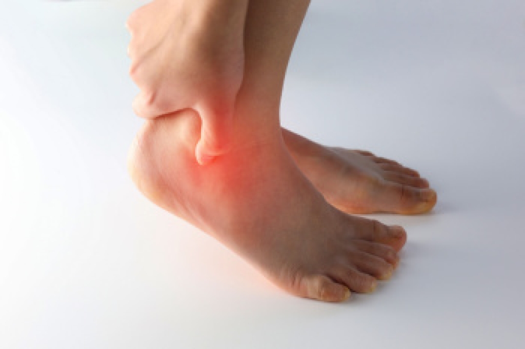 Gout Can Affect the Ankles, Too